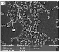 Impact of T6 Heat Treatment on ADC12 Aluminum Alloy Properties