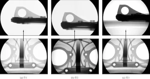 X-ray inspection image