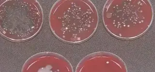 How Many Bacteria Will Be When Wearing A Mask for One Day?