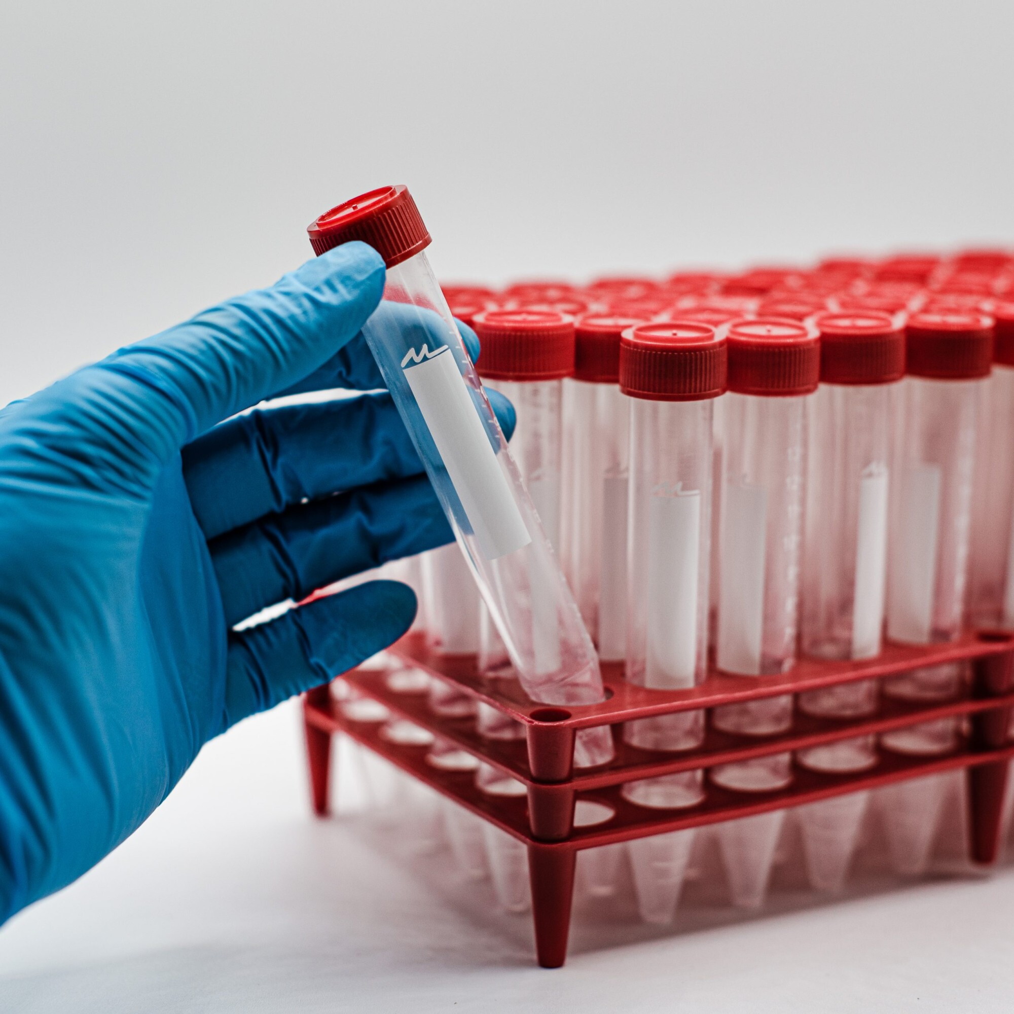 Application and Function of Centrifuge Tubes