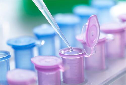 Common Pipetting Errors and Prevention