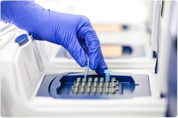 How to Use qPCR to Detect Cellular Inflammatory Factors