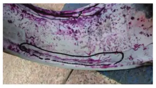 PT flaw detection of the inner and outer weld seam surfaces of the surge pipe elbows in the top cover