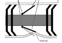 How Pipe Deformation Affects Magnetic Flux Leakage (MFL) Detection: Case Study Analysis