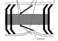 How Pipe Deformation Affects Magnetic Flux Leakage (MFL) Detection: Case Study Analysis