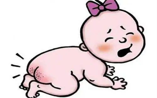How to deal with and prevent baby diaper rash