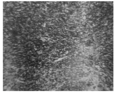 500x magnification of tempered troostite 500x magnification of tempered troostite